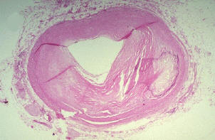 adipon3.jpg