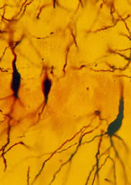 neurones.jpg