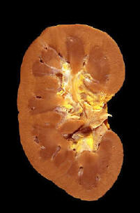 kidney1.jpg