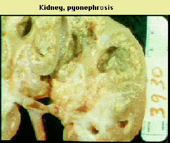 kidney2.jpg